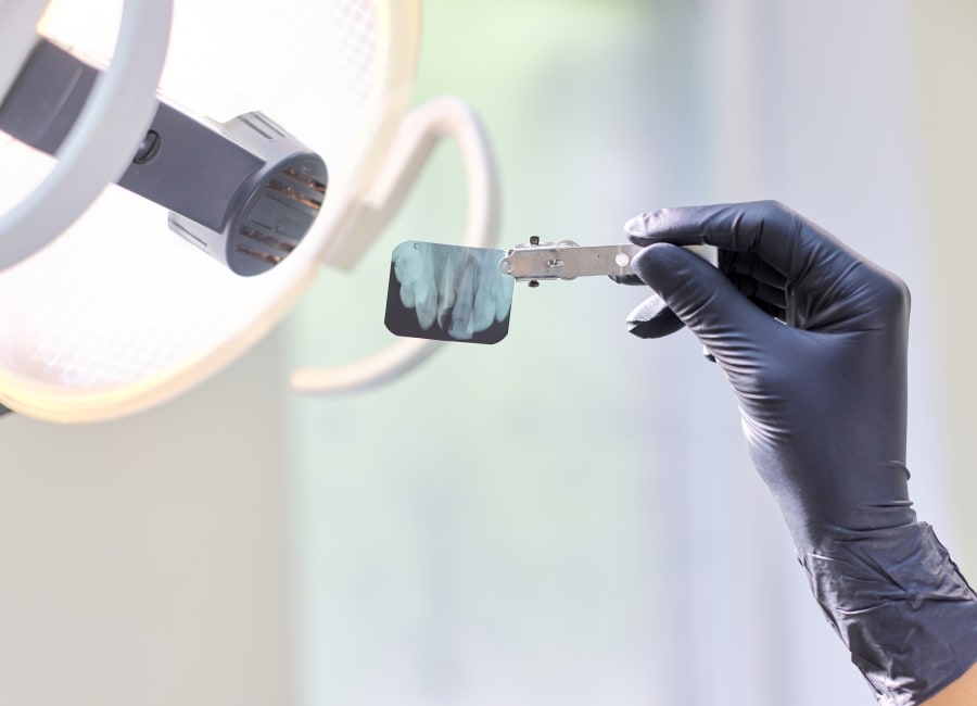 Digital X-rays, Lake Oswego Orthodontist