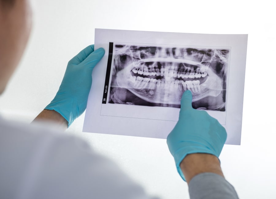 Panoramic X-rays, Lake Oswego Orthodontist